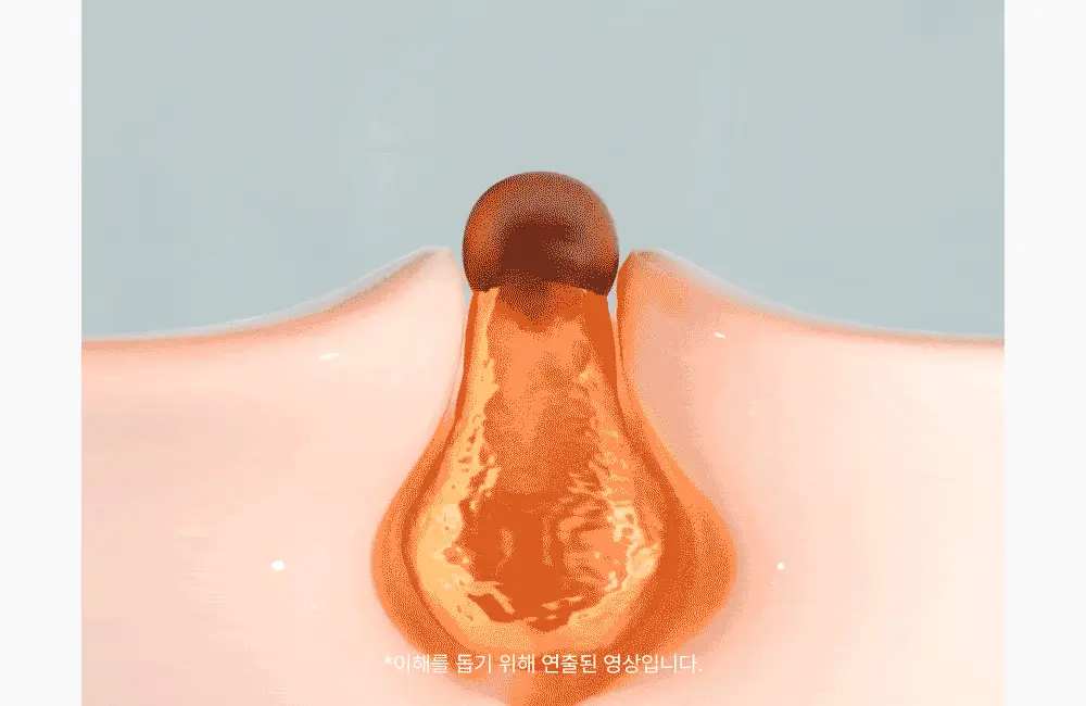 [트러블 스케일링] 이옴 트러블 패치 마스크 3매 상세페이지 17
